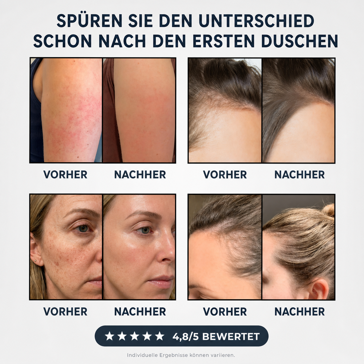 Vorher/Nachher