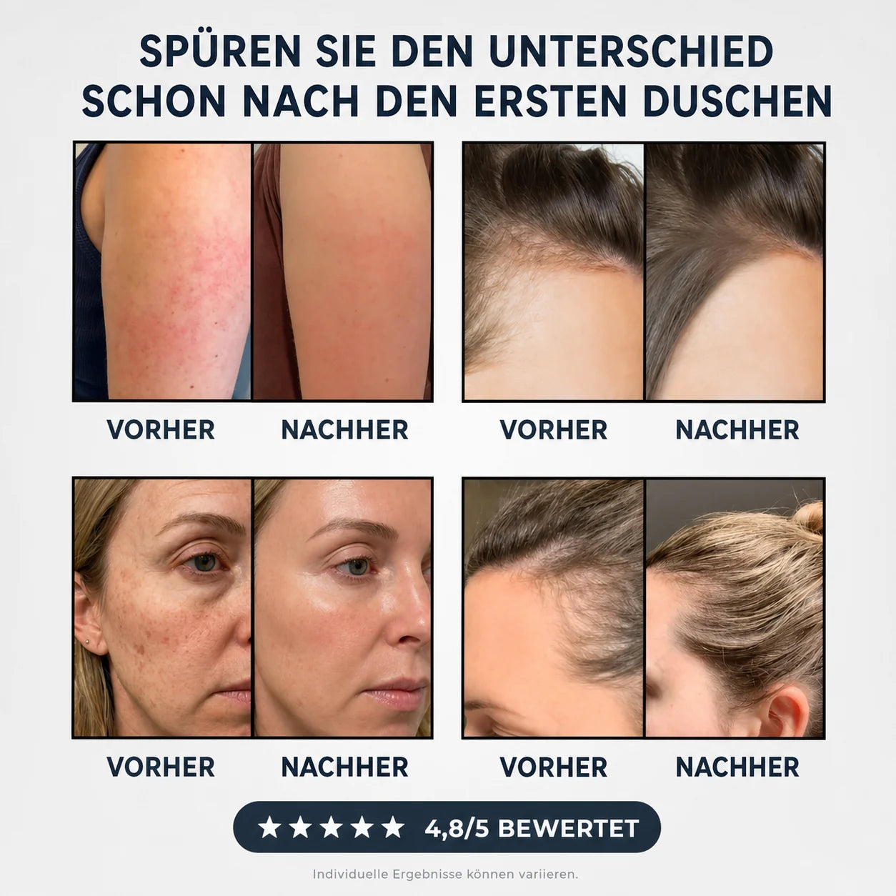 Vorher/Nachher