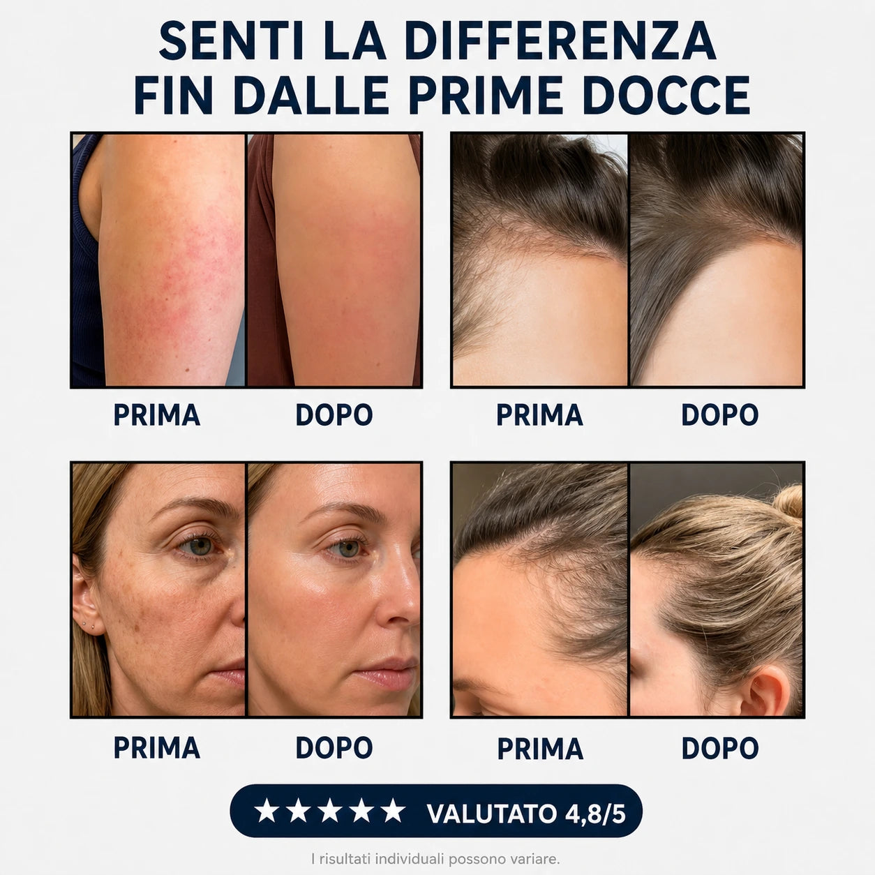 Prima/Dopo