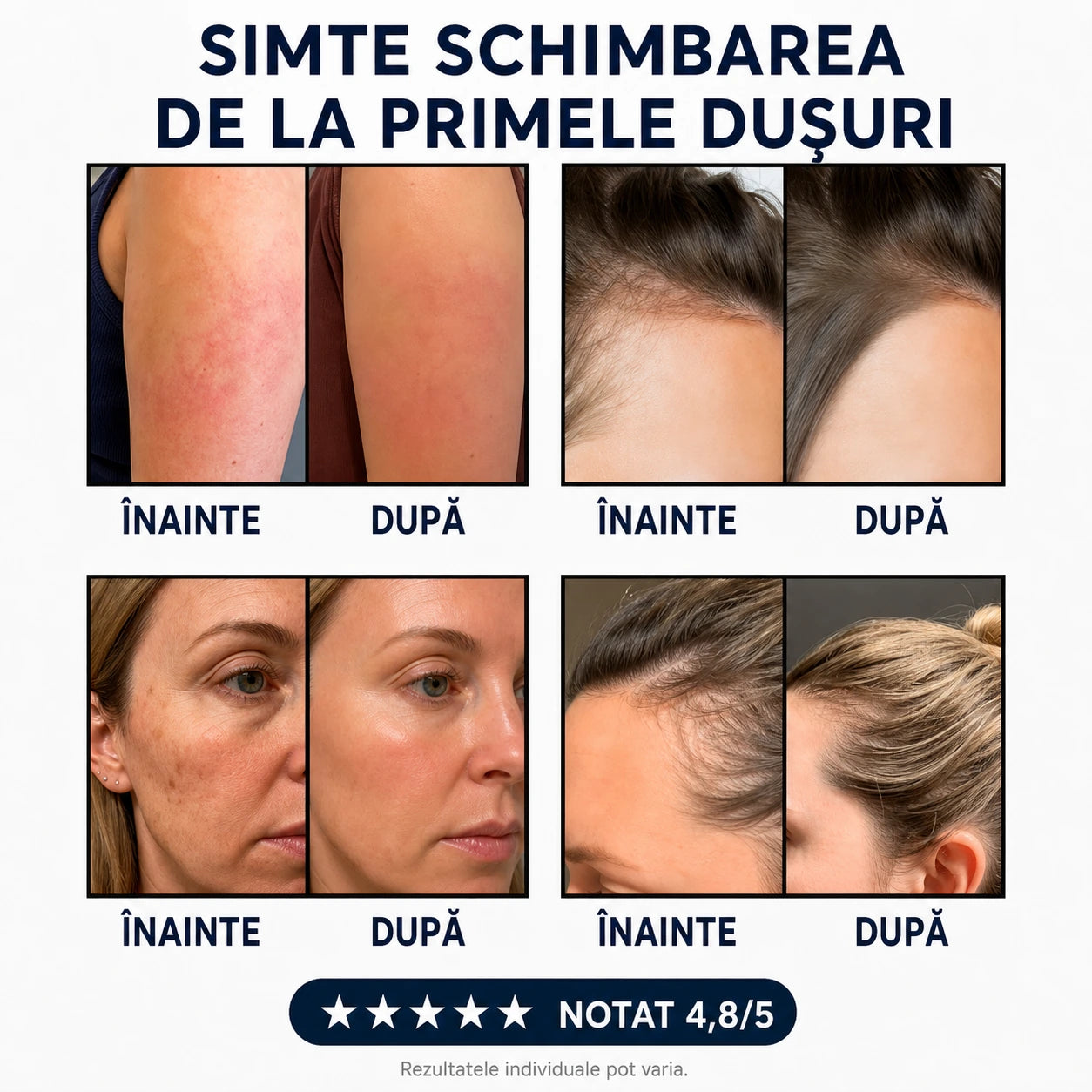 Înainte/După